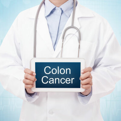 4 Early Warning Signs of Colon Cancer