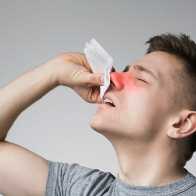 8 Natural Remedies for Nasal Polyps