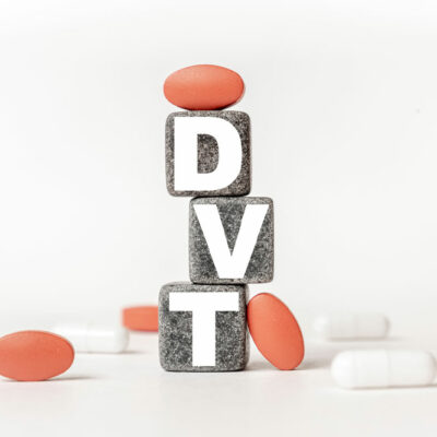 DVT Complications and Preventive Measures